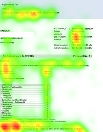 Eyetracking Augenbeweg