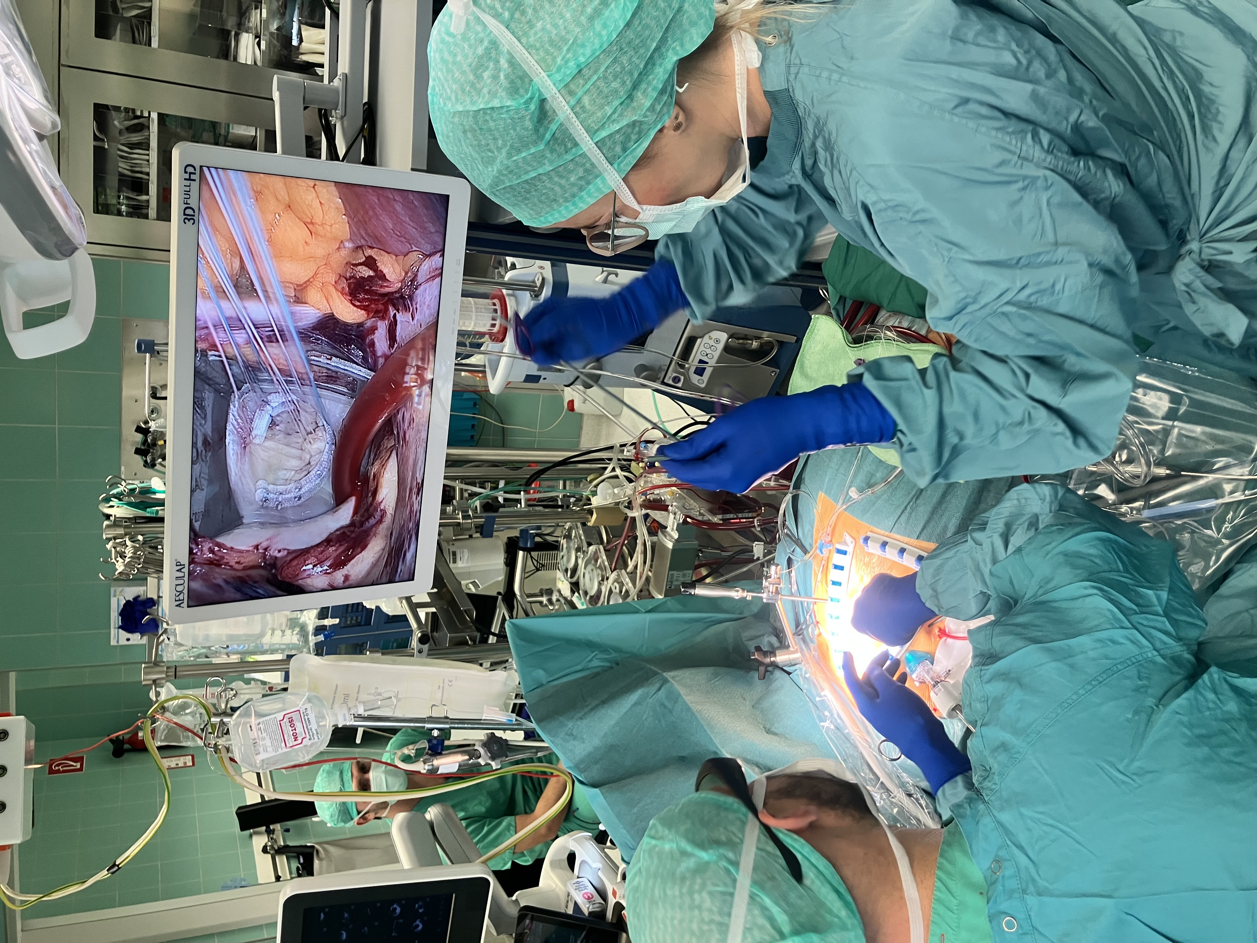 Der Chirurg (l.) sitzt mit 3D-Brille am OP-Tisch und operiert endoskopisch über den Bildschirm.