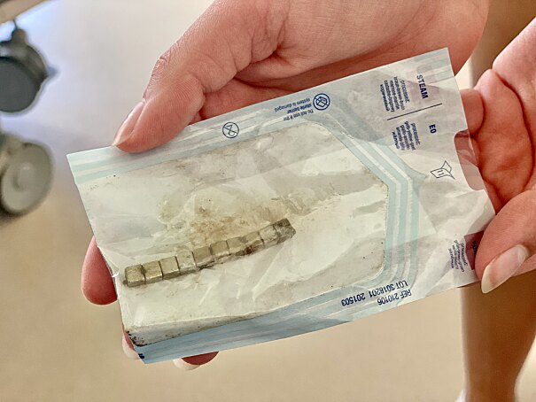 Diese zehn kleine Magneten hatte der 21 Monate alte Alparslan verschluckt. Daran wäre er fast gestorben.