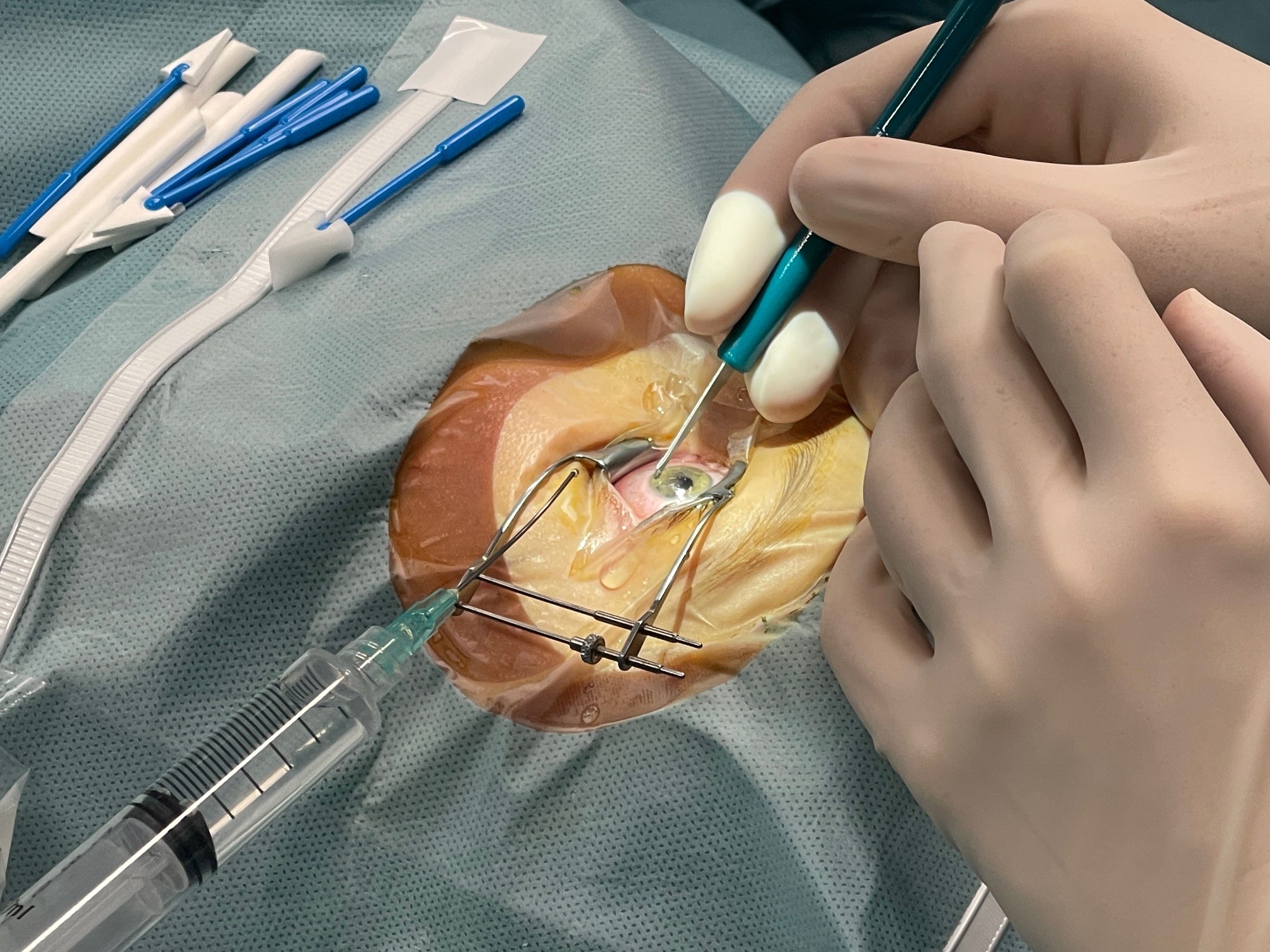 Die Universitätsklinik für Augenheilkunde am Uniklinikum Salzburg hat auch einen mikrochirurgischen und plastisch chirurgischen Schwerpunkt.